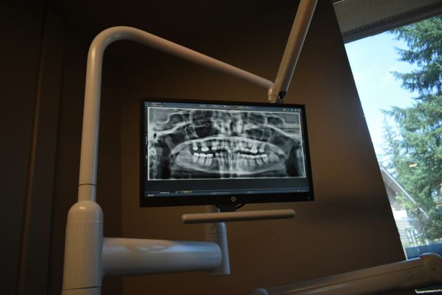 Panoráma vagy 3D? Mikor térül meg a CT-berendezés